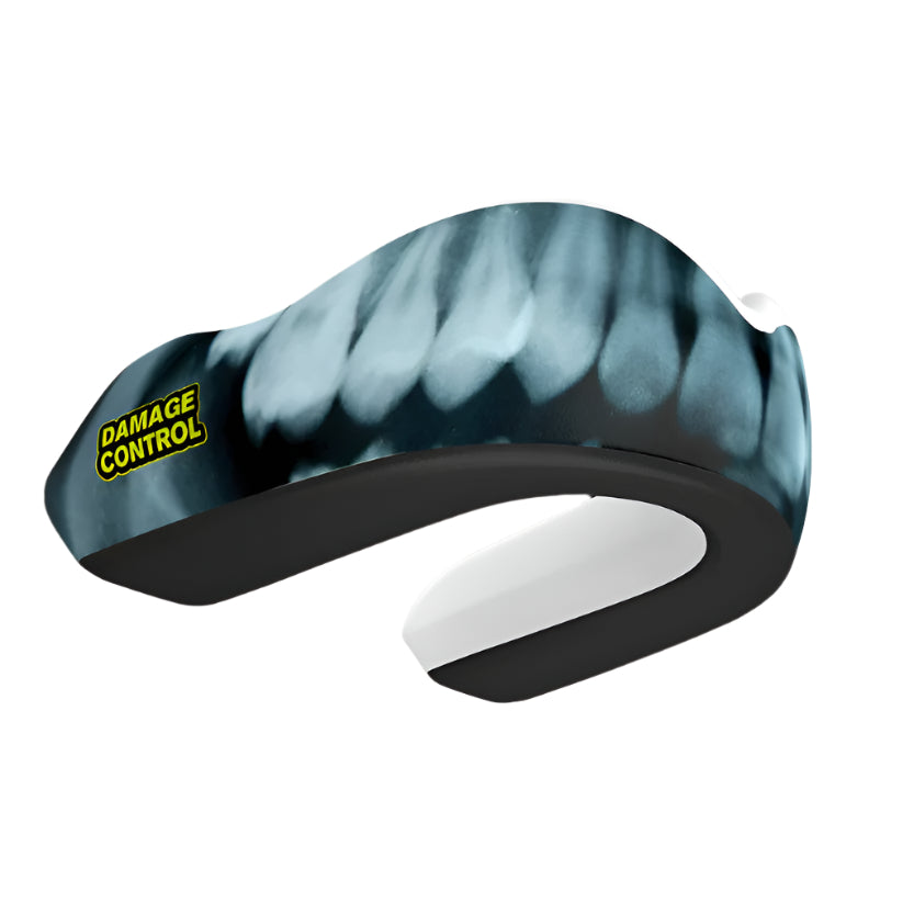 Der Damage Control Zahnschutz X-Ray aus der Extreme Impact Series schützt deine Zähne zuverlässig bei intensivem Sparring und Wettkampf. Ideal für MMA, Boxen und Muay Thai.