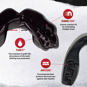 Schwarzer Mundschutz aus der Intro Series von SafeJawz – perfekt für Anfänger und Hobbysportler. Einfach anzupassen, angenehm zu tragen und zuverlässig im Schutz von Zähnen und Kiefer.