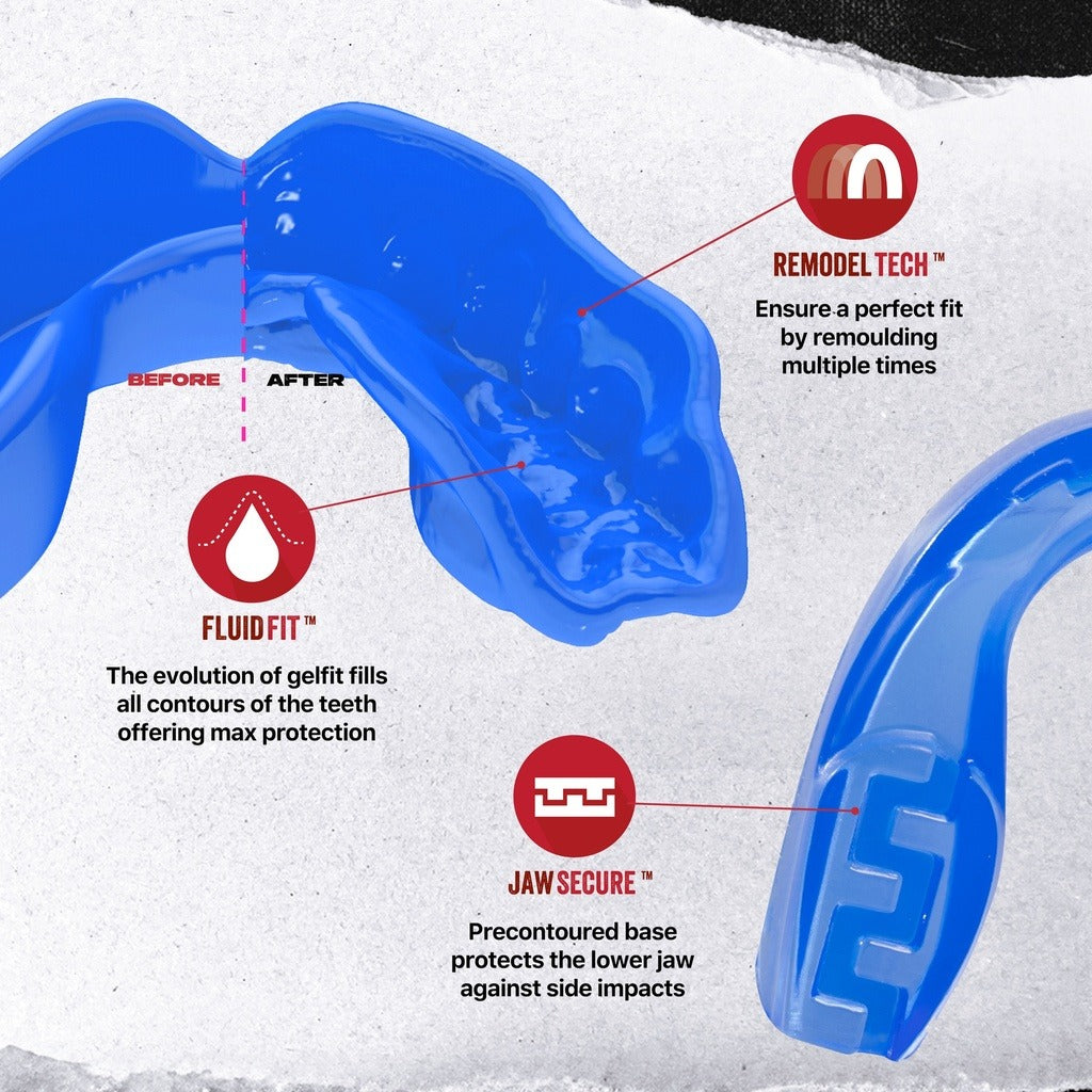 Klarer Safejawz Extro Series „Ice Blue“ Zahnschutz: Die innovative JawSecure™-Technologie stabilisiert den Unterkiefer und schützt bei seitlichen Einwirkungen – für Sicherheit ohne Kompromisse. 